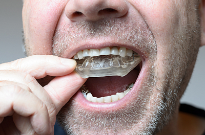 MOUTHGUARD FOR BRUXISM