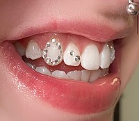 TOOTH JEWELLERY